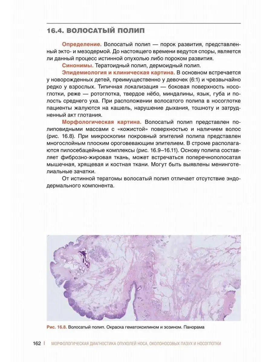 Морфологическая диагностика опухолей носа, околоносовых ... Практическая  медицина 163793177 купить в интернет-магазине Wildberries